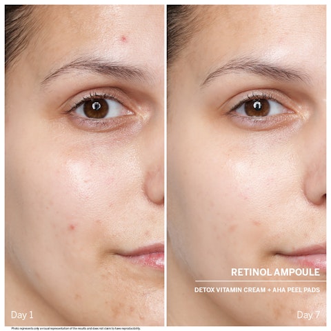 Ампулы с Ретинолом DOCTOR BABOR