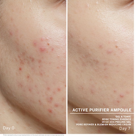 Ампулы для Проблемной Кожи